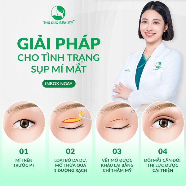 Phẫu thuật sụp mí mắt (nâng mí)