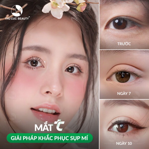 sua mi sup e1767927061338