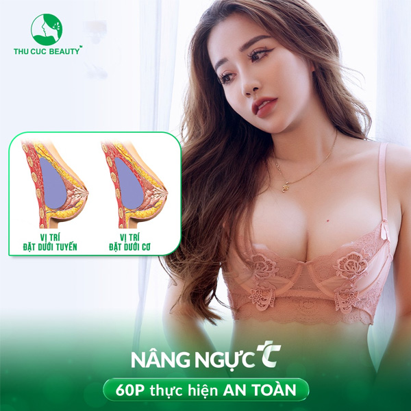 Nâng ngực TC 4.0
