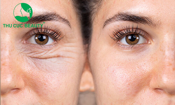 cat da thua mi duoi 1