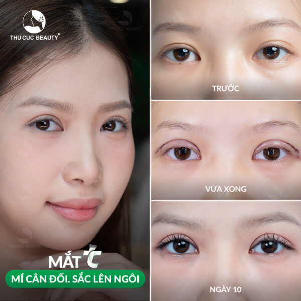 cat mi mat 1 e1767869098122