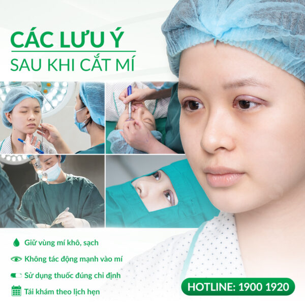 cham soc sau cat mi e1784104303908