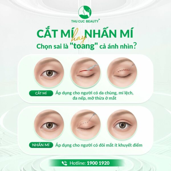 Nhấn Mí Mắt 2 nhan mi 1 e1784109096764