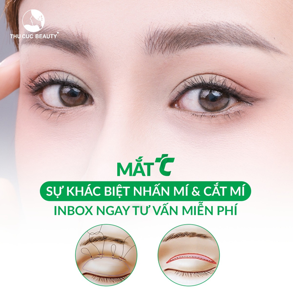 Nhấn Mí Mắt