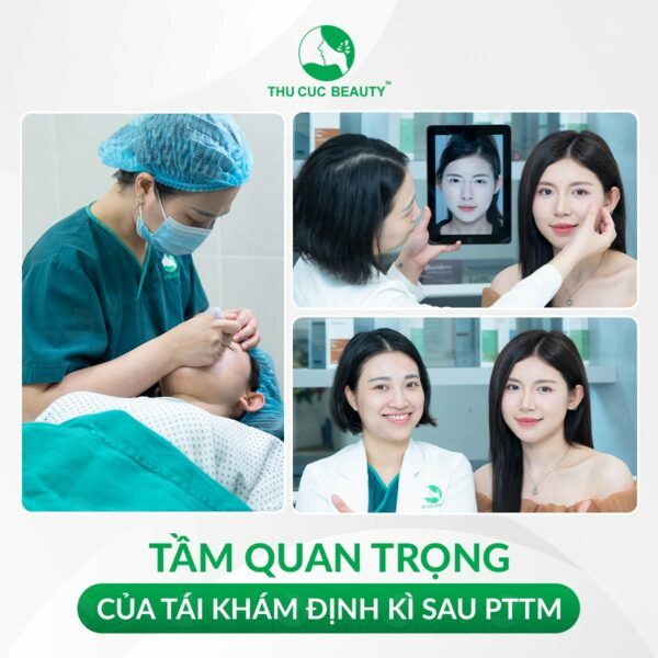 tai kham sau cat mi e1784106586656