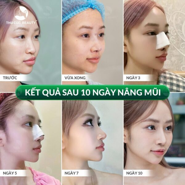 bieu hien sau nang mui e1784111173467