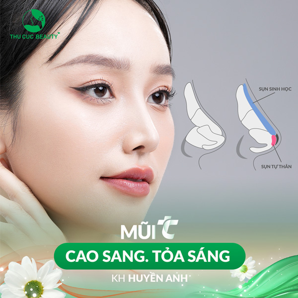 Nâng mũi bán cấu trúc