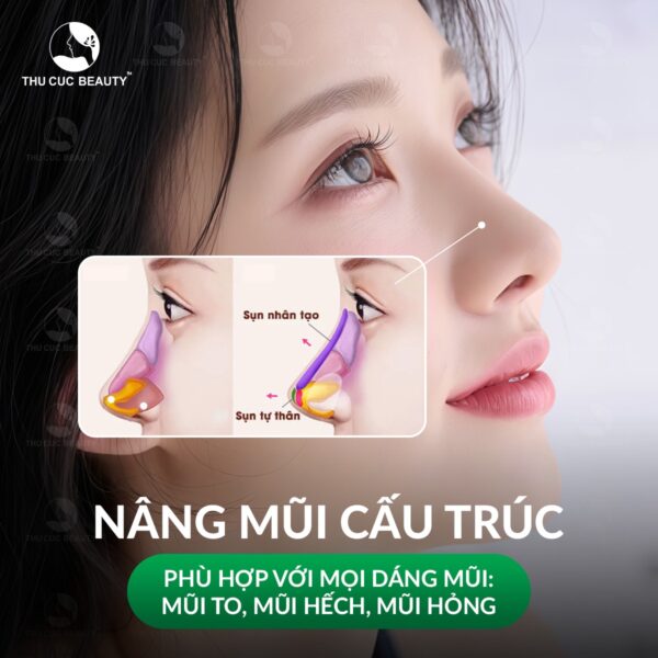 nang mui cau truc thu nen mui e1767933226554
