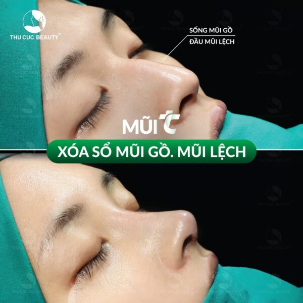 nang mui khoam e1784112727370