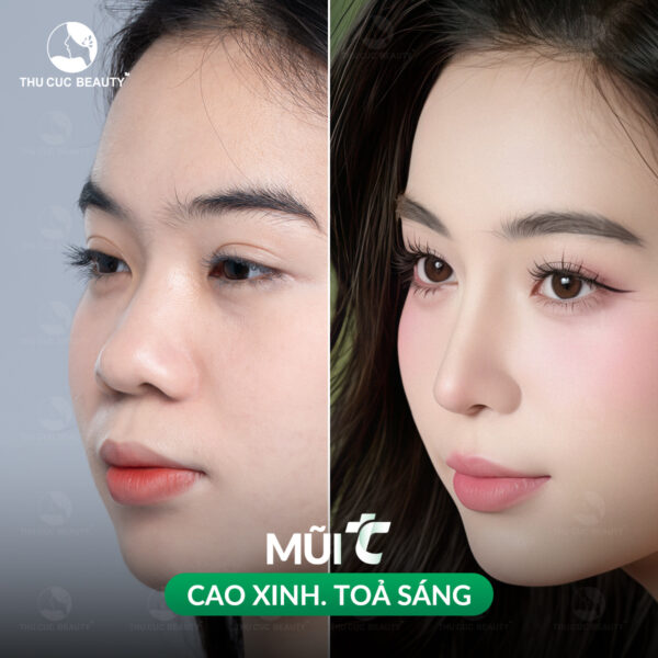 nang mui tai thu cuc e1767933364154