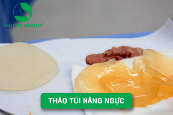 Rút Chất Liệu Ngực: Phẫu Thuật Tháo Túi Độn Ngực