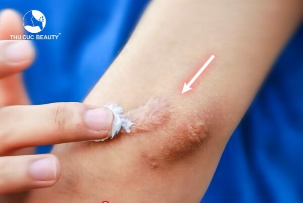 dieu tri seo 1 e1768189982891