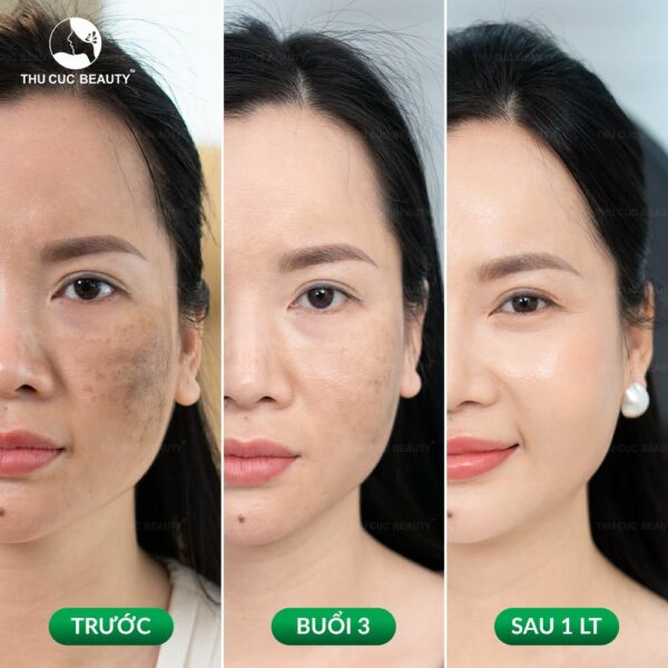 tre hoa da tri nam e1784286598789