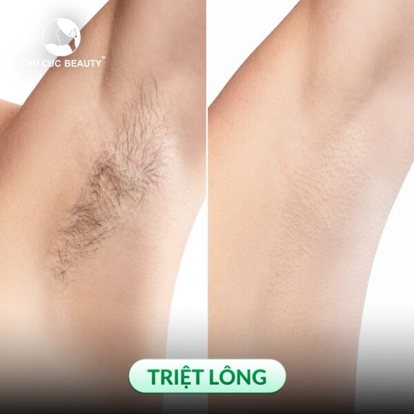 triet long thu cuc e1768189247963