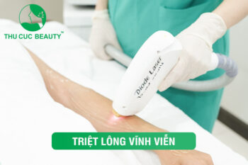 Triệt lông bằng laser: Giải pháp cho làn da mịn màng