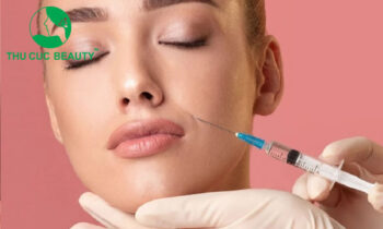 Những điều cần biết về tiêm filler rãnh cười