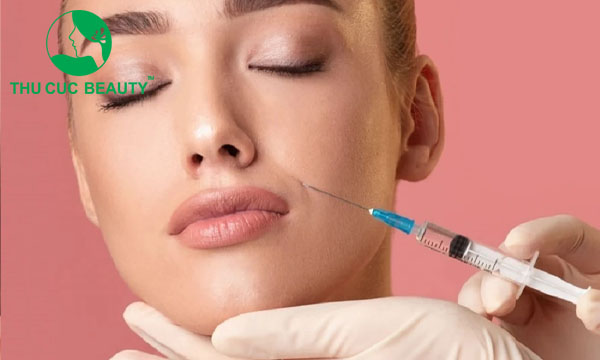 Tiêm filler rãnh cười giúp khuôn mặt trẻ trung hơn.