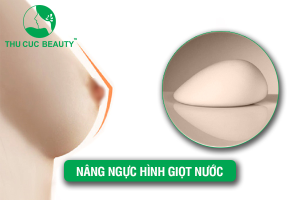 Có nên nâng ngực hình giọt nước không? 
