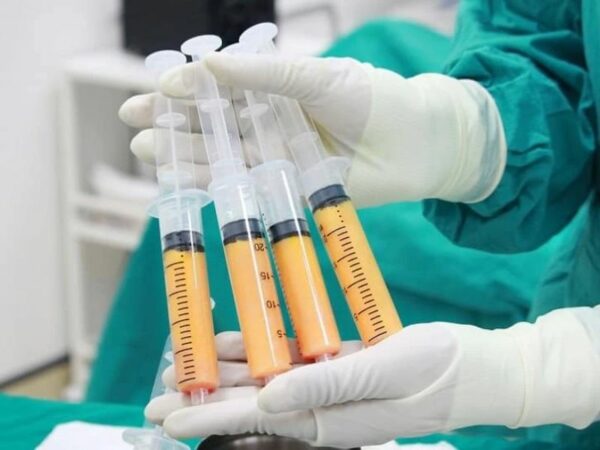 Hút mỡ bụng bơm lên ngực là phương pháp gì? Có an toàn không?