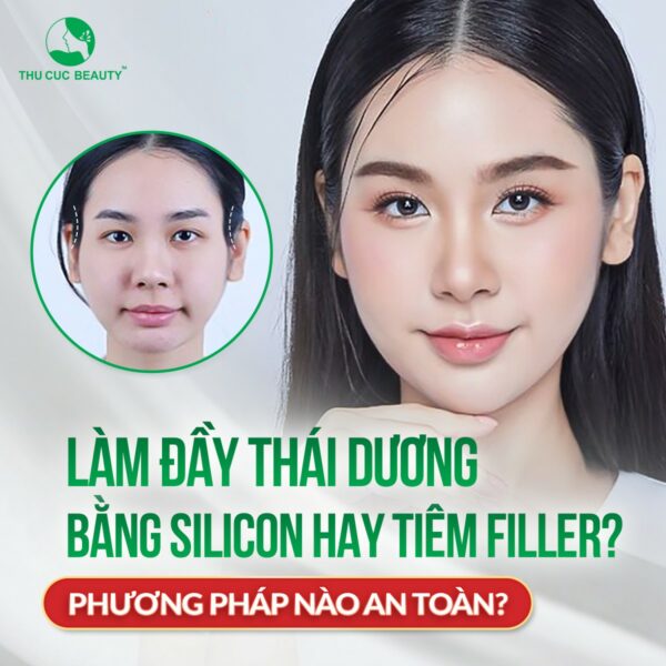 thai duong hop e1773138689845