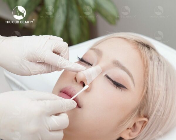 Tuổi thọ của nâng mũi được bao lâu? Phương pháp nào bền nhất?