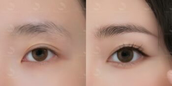 Điêu khắc chân mày và những điều cần biết