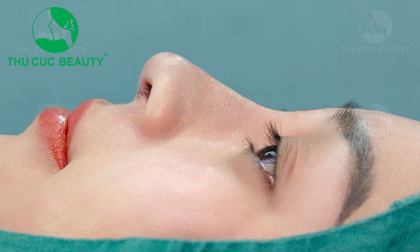 Nâng mũi thường không để lại sẹo.