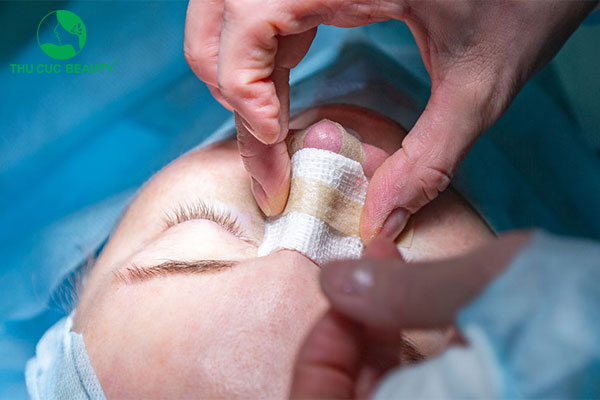 Nâng mũi bao lâu thì tụt? Làm sao để tránh bị tụt sống mũi sau nâng? 2 Nâng mũi bao lâu thì tụt?