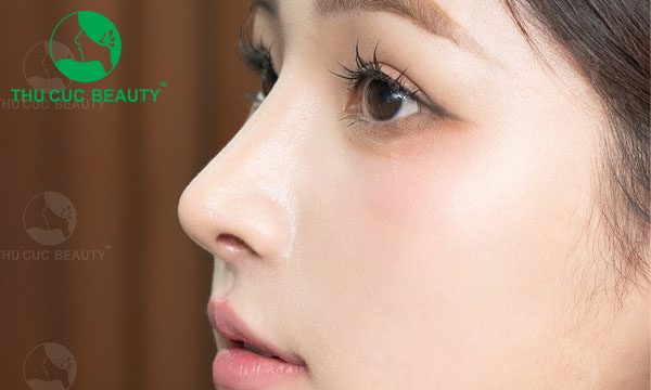 Nâng mũi tự nhiên