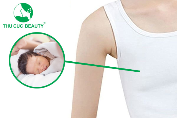 Ngực lép sau sinh