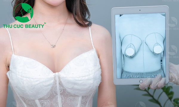 Treo ngực sa trễ có để lại sẹo không?