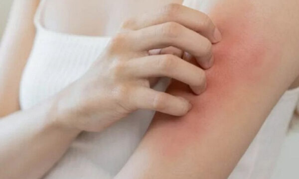 Triệt lông có đau không? Làm sao để hết đau? 2 Triệt lông có đau không?