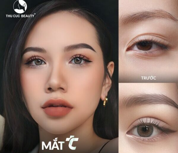 Cắt mí có đắt không? Cần lưu ý những gì khi đi cắt mí?