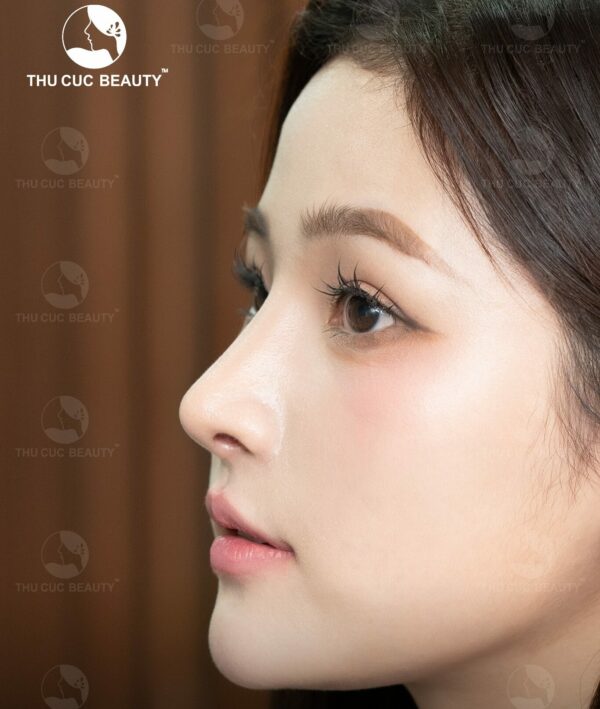 Các dáng mũi đẹp hiện nay, nâng mũi ở đâu uy tín? 3 Dáng mũi L-line đẹp hiện nay