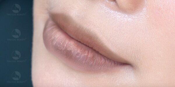 Cấy môi sinh học và những điều cần biết 2 Cấy môi sinh học giúp môi tươi tắn và căng mọng hơn.