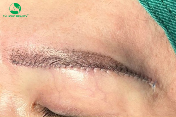 Nâng cung mày ở đâu đẹp? Chia sẻ kinh nghiệm khi đi nâng cung mày 2 Nâng cung mày giúp gương mặt trẻ trung hơn.