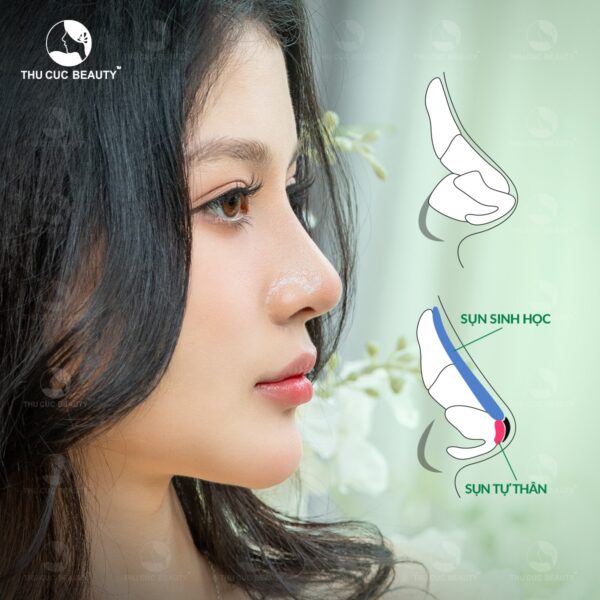 Sụn nâng mũi sinh học có tính tương thích rất cao.