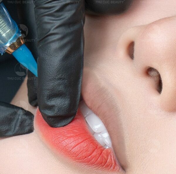 Cấy môi sinh học và những điều cần biết 3 Cấy môi sinh học có thể duy trì hiệu quả đến 5 năm.