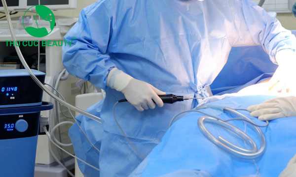 Quy trình hút mỡ an toàn.