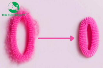 Trẻ hóa vùng kín và những điều cần biết