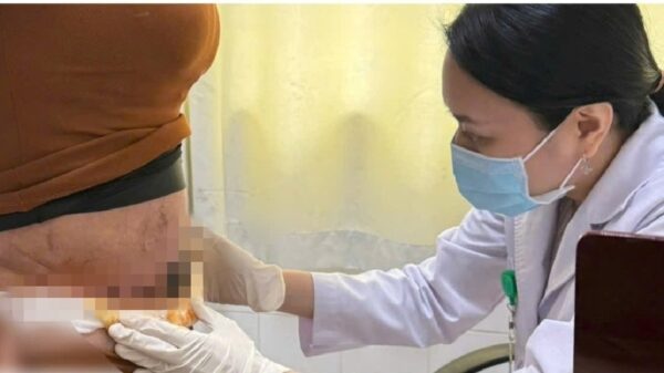 Hút mỡ bụng bị nhiễm trùng do thực hiện tại cơ sở không uy tín.