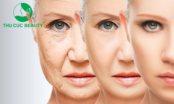 Căng chỉ da mặt giữ được bao lâu? Có nên căng chỉ da mặt không? 2 Căng chỉ da mặt