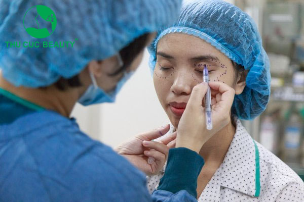 Cấy mỡ hốc mắt bao nhiêu tiền? 2 Cấy mỡ hốc mắt giúp đôi mắt trẻ đẹp, tươi tắn hơn.