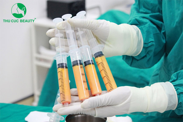 Cấy mỡ tự thân lên mặt là gì? Những điều cần lưu ý 3 Quy trình cấy mỡ tự thân lên mặt