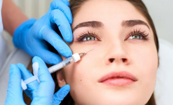 Làm đầy vùng mắt dưới bằng filler