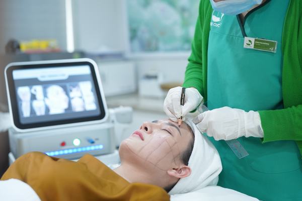 Giải pháp giúp duy trì kết quả nâng cơ căng da 3 Căng da nâng cơ mặt trẻ hóa