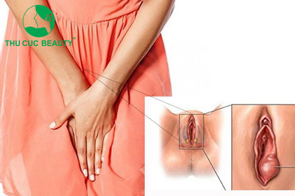 Phẫu thuật tầng sinh môn bao nhiêu tiền? 1 Phẫu thuật tầng sinh môn