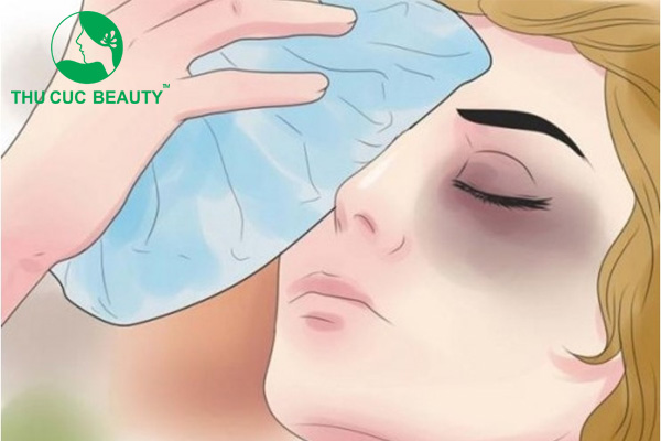 Làm sao để giảm sưng sau nâng mũi? 2 Cách giảm sưng sau nâng mũi.