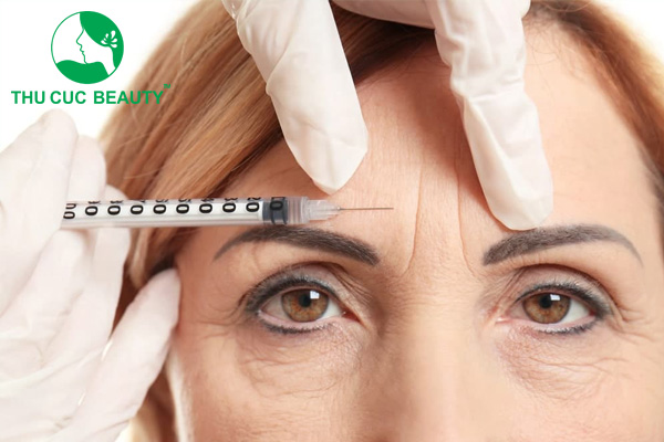 Xóa nhăn trán bằng botox bao nhiêu tiền? 2 Xóa nhăn trán bằng botox bao nhiêu tiền?
