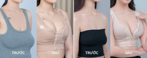 treo sa tre nguc mac ao dinh hinh bao lau e1761813581385